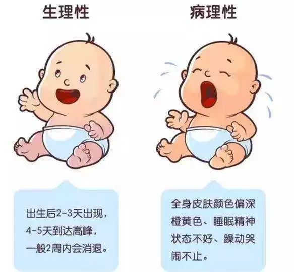 婴儿半个月黄疸还没退婴儿半个月黄疸未退，原因、影响与应对措施